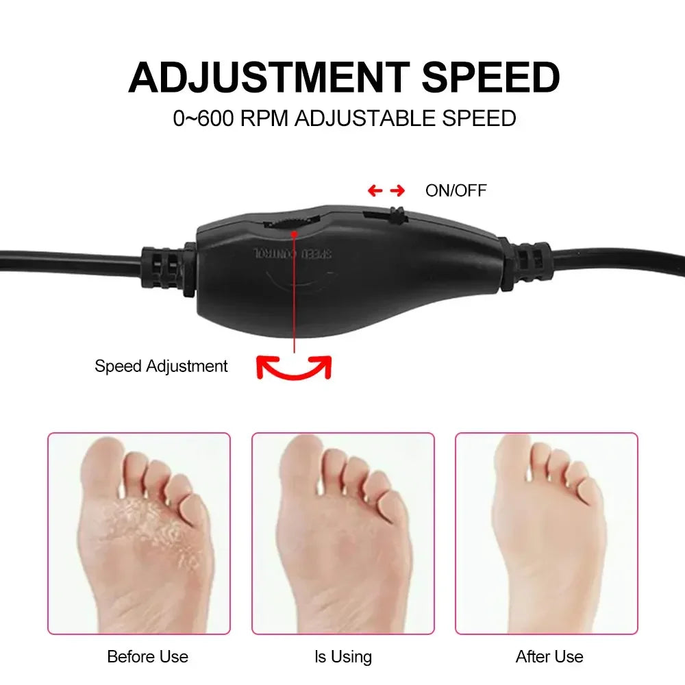 Foot Callus Remover