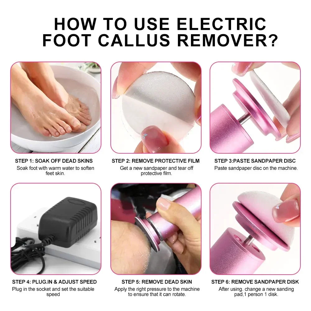 Foot Callus Remover