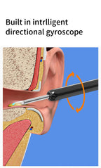 NATFIRE NE3 Smart Ear Cleaner