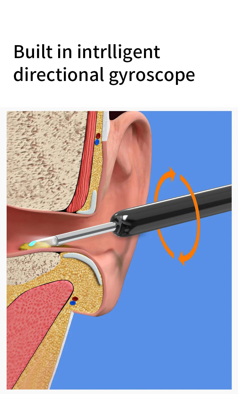 NATFIRE NE3 Smart Ear Cleaner