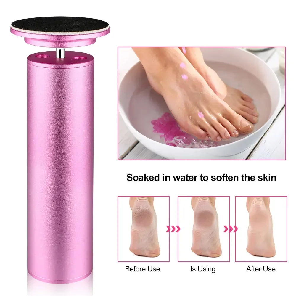 Foot Callus Remover